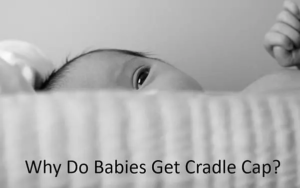 Babe In Dreamland - Why Do Babies Get Cradle Cap? (Here’s What You Need To Know)