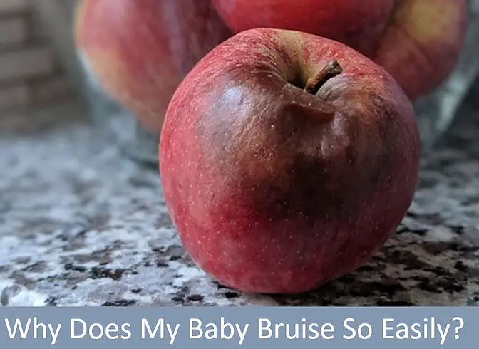 Why Does My Baby Bruise So Easily? - babe in dreamland