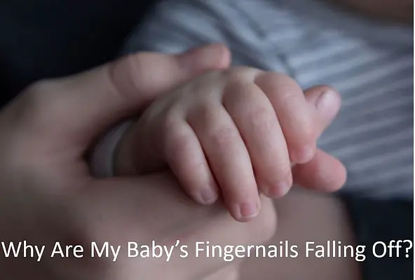 Why Are My Baby's Fingernails Falling Off? (The 6 Most Common Reasons) -  Babe In Dreamland